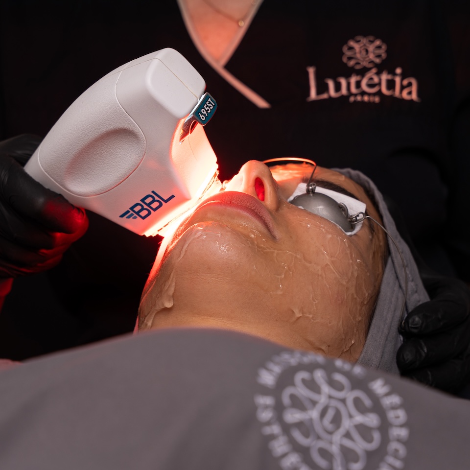 PIGMENTATION TREATMENT IN LUTETIA DUBAI copy