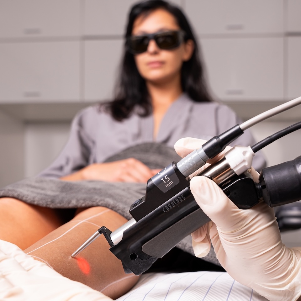 laser hair removal on female patient