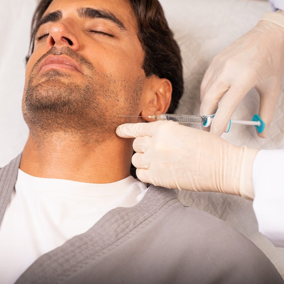 Dermal filler for jaw contouring for male patient